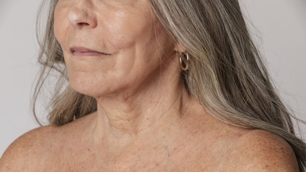 Natural signs of neck ageing and reduced jawline definition in mature woman